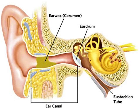 symptoms of cerumen impaction